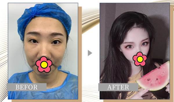 嗯啊H客厅HH青梅H涨奶视频
