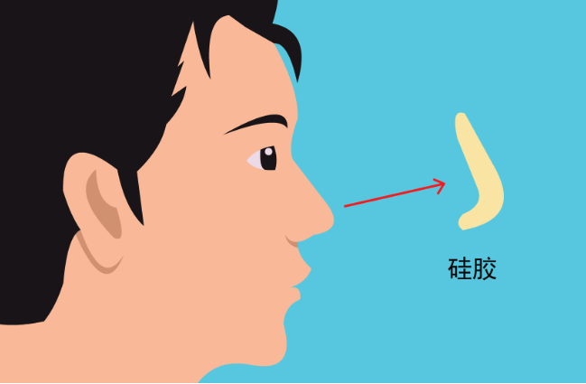 隔壁不穿乳罩的太太