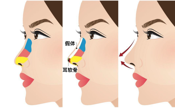 重慶軍科林勇做鼻子怎么樣?從個(gè)人簡(jiǎn)歷看他隆鼻技術(shù)先進(jìn)價(jià)格值 18岁看黄禁用免费a入口