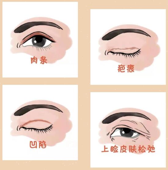 年轻漂亮的继4高清
